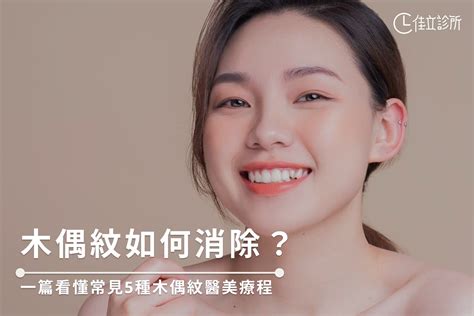 木偶紋|木偶紋如何消除？了解形成5大原因，費用花在刀口上！